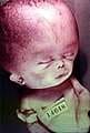 The Starchild skull
